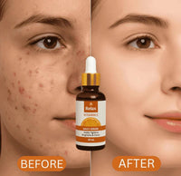 Relax Vitamin C Daily Serum – Glow And Radiance In Every Drop With Brightening Anti Aging Hydration Formula For Healthy Skin – Net Quantity 30ml
